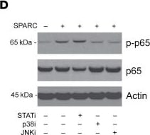 Detection of SPARC by Western Blot