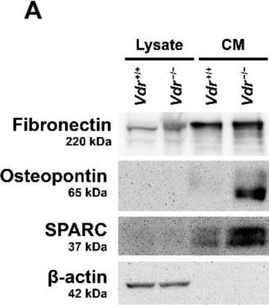 Detection of SPARC by Western Blot