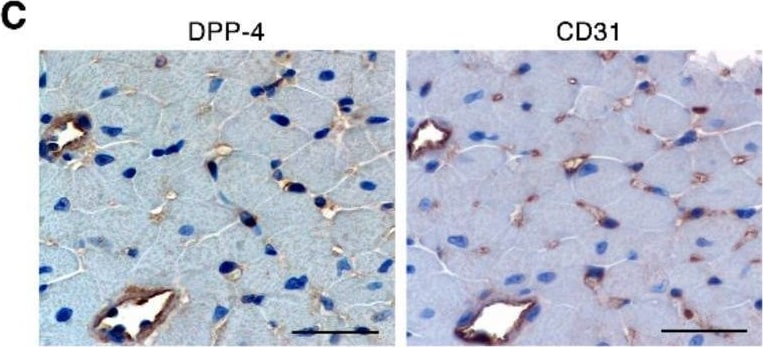 Detection of DPPIV/CD26 by Immunohistochemistry