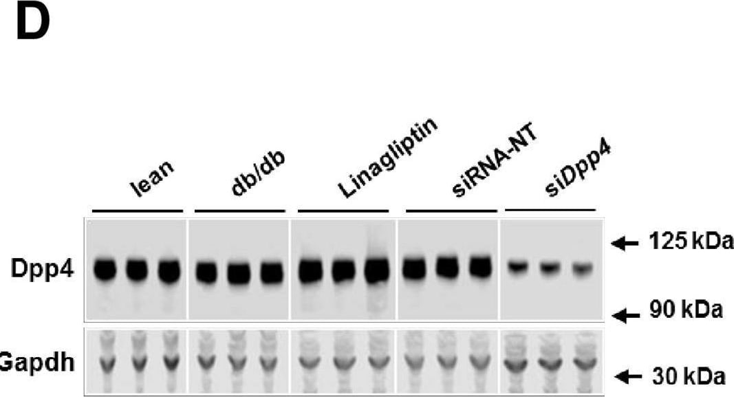Detection of DPPIV/CD26 by Western Blot