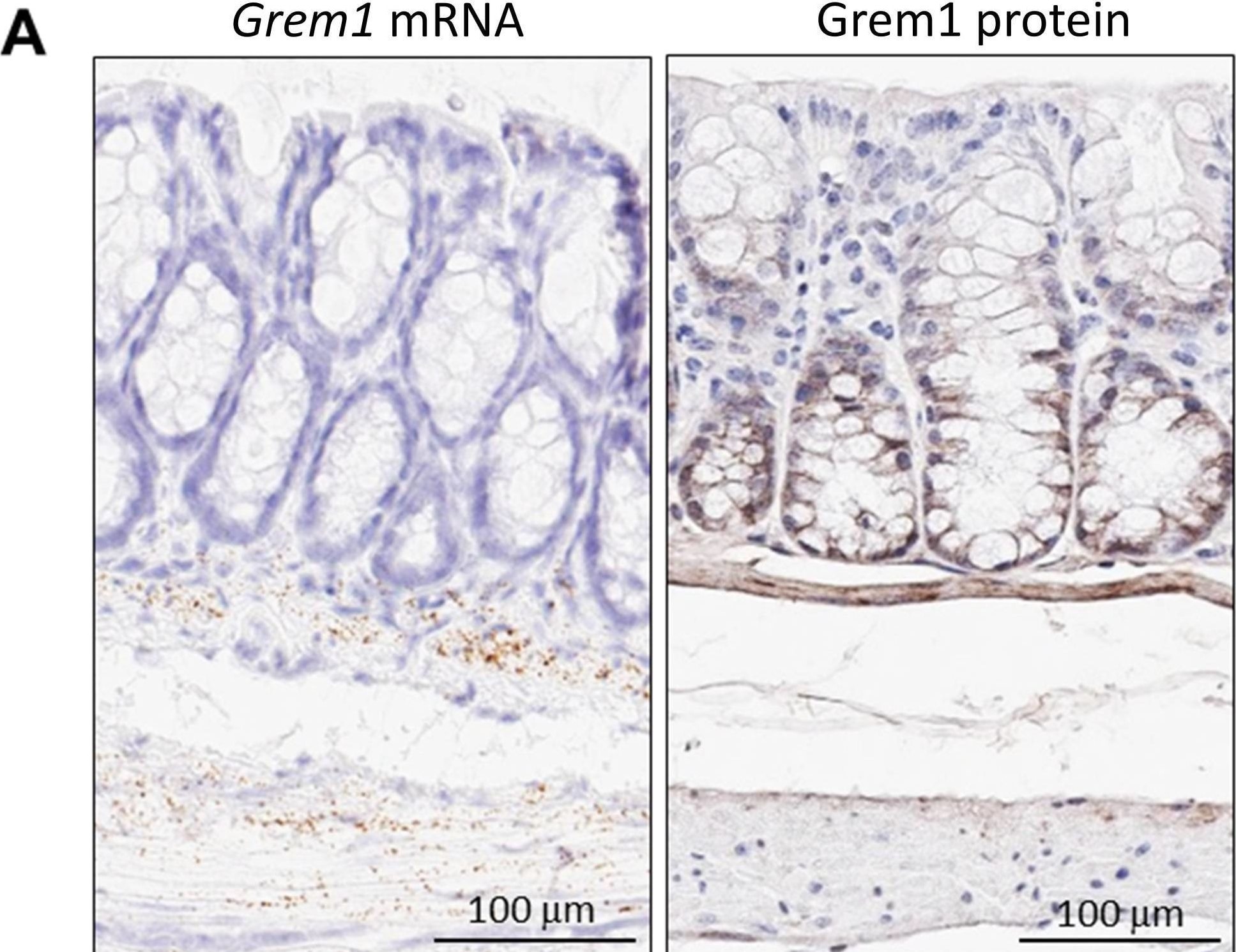 Detection of Gremlin by Immunohistochemistry