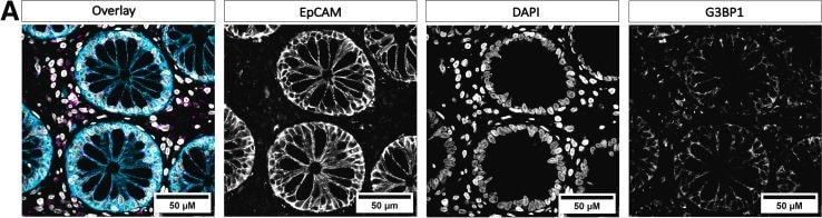 Detection of EpCAM/TROP1 by Immunohistochemistry
