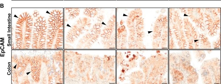 Detection of EpCAM/TROP1 by Immunohistochemistry