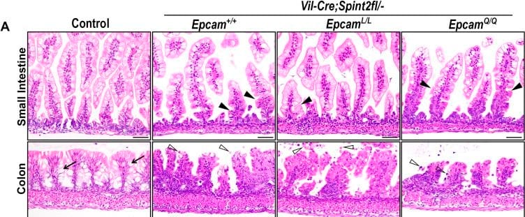 Detection of EpCAM/TROP1 by Immunohistochemistry