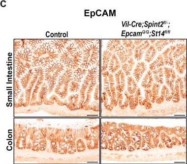 Detection of EpCAM/TROP1 by Immunohistochemistry