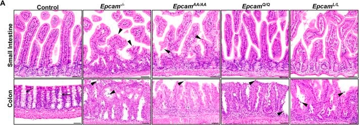 Detection of EpCAM/TROP1 by Immunohistochemistry