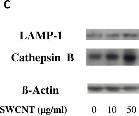 Detection of Cathepsin B by Western Blot