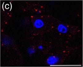 Detection of Mouse Cathepsin B by Immunocytochemistry/ Immunofluorescence