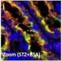 Detection of Mouse Cathepsin B by Immunocytochemistry/ Immunofluorescence