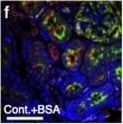 Detection of Mouse Cathepsin B by Immunocytochemistry/ Immunofluorescence