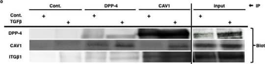 Detection of Mouse Cathepsin B by Western Blot