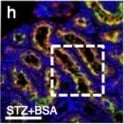 Detection of Mouse Cathepsin B by Immunocytochemistry/ Immunofluorescence