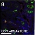 Detection of Mouse Cathepsin B by Immunocytochemistry/ Immunofluorescence