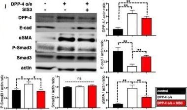 Detection of Mouse Cathepsin B by Western Blot