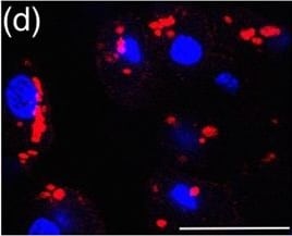 Detection of Mouse Cathepsin B by Immunocytochemistry/ Immunofluorescence