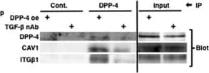 Detection of Mouse Cathepsin B by Western Blot