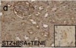 Detection of Mouse Cathepsin B by Immunohistochemistry