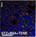 Detection of Mouse Cathepsin B by Immunocytochemistry/ Immunofluorescence