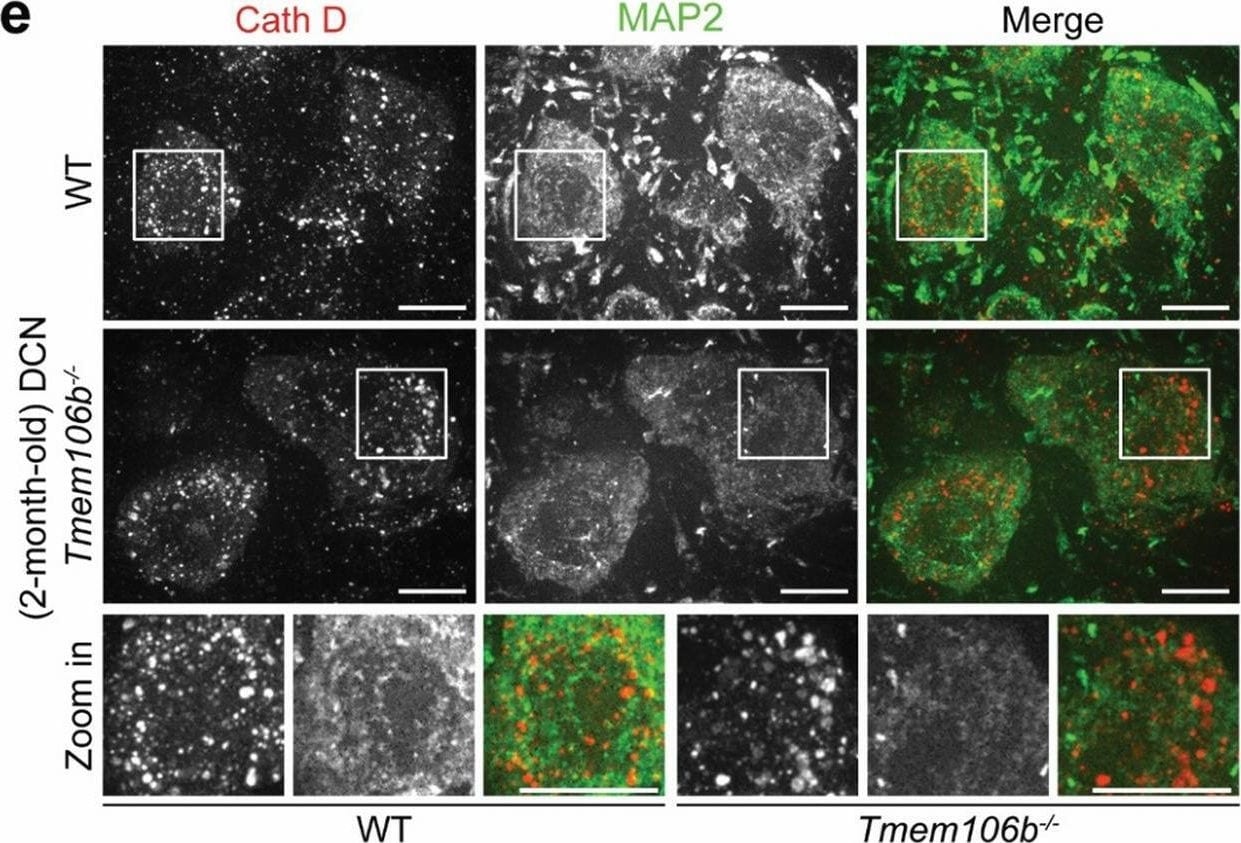 Detection of Mouse Cathepsin B by Immunocytochemistry/ Immunofluorescence