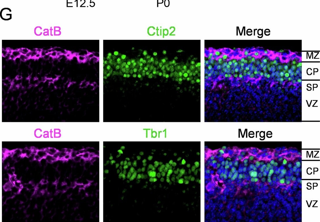 Detection of Cathepsin B by Immunohistochemistry