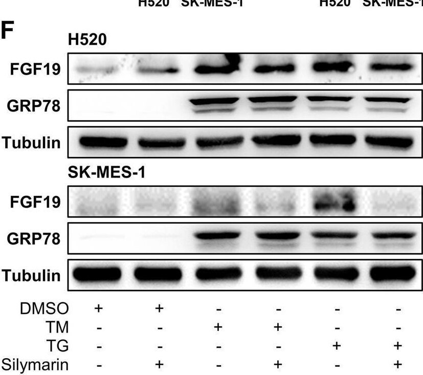 Detection of FGF-19 by Western Blot