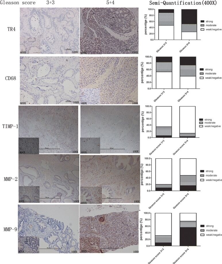 Detection of Human TIMP-1 by Immunohistochemistry-Paraffin