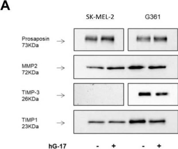 Detection of Mouse TIMP-1 by Western Blot