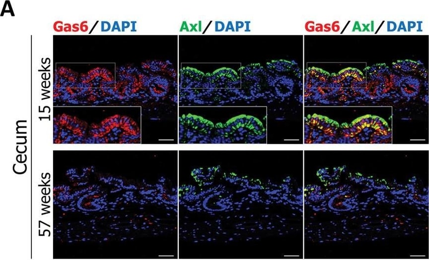 Detection of Gas6 by Immunohistochemistry