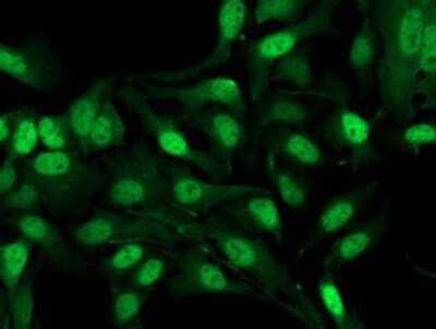 Immunocytochemistry/ Immunofluorescence: alcohol dehydrogenase 1B Antibody (OTI4F12) [NBP2-00649]