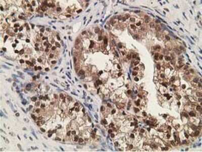 Immunohistochemistry-Paraffin: alcohol dehydrogenase 1B Antibody (OTI4F12) [NBP2-00649]