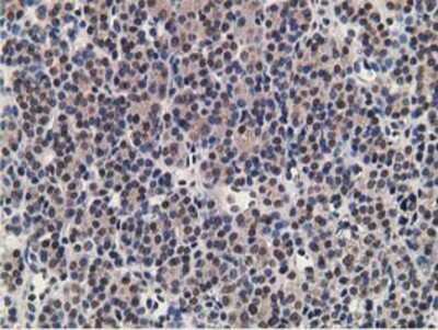 Immunohistochemistry-Paraffin: alcohol dehydrogenase 1B Antibody (OTI4F12) [NBP2-00649]