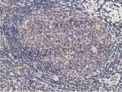 Immunohistochemistry-Paraffin: alcohol dehydrogenase 1B Antibody (OTI4F12) [NBP2-00649]