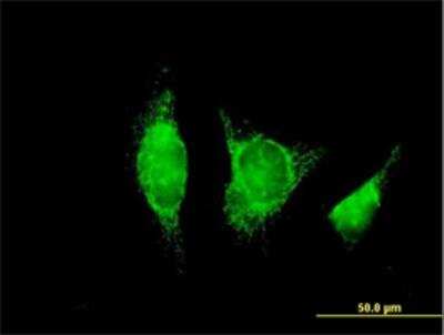 Immunocytochemistry/ Immunofluorescence: alcohol dehydrogenase 1B Antibody [H00000125-B01P]