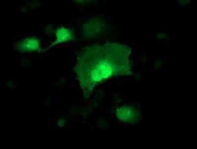 Immunocytochemistry/ Immunofluorescence: alcohol dehydrogenase 1B Antibody (OTI4F12) - Azide and BSA Free [NBP2-70092]