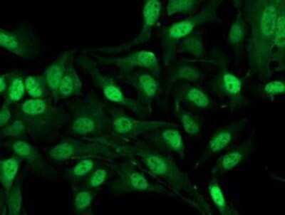 Immunocytochemistry/ Immunofluorescence: alcohol dehydrogenase 1B Antibody (OTI4F12) - Azide and BSA Free [NBP2-70092]