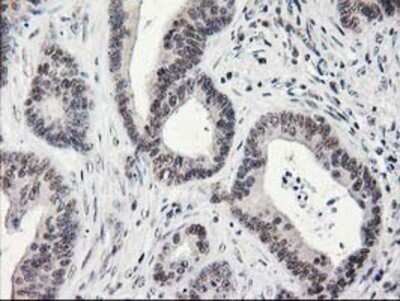 Immunohistochemistry: alcohol dehydrogenase 1B Antibody (OTI4F12) - Azide and BSA Free [NBP2-70092]