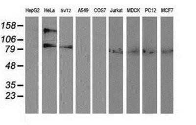 Western Blot: alcohol dehydrogenase 1B Antibody (OTI4F12)Azide and BSA Free [NBP2-70092]
