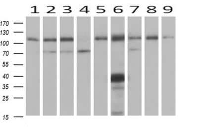 Western Blot: alcohol dehydrogenase 1B Antibody (OTI4F12) [NBP2-00649]