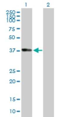 Western Blot: alcohol dehydrogenase 1B Antibody [H00000125-B01P]
