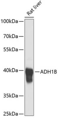 Western Blot: alcohol dehydrogenase 1B AntibodyBSA Free [NBP2-92149]