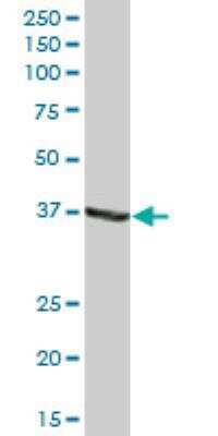 Western Blot: alcohol dehydrogenase 1C Antibody [H00000126-B01P]