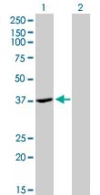 Western Blot: alcohol dehydrogenase 4 Antibody (3C5) [H00000127-M01]