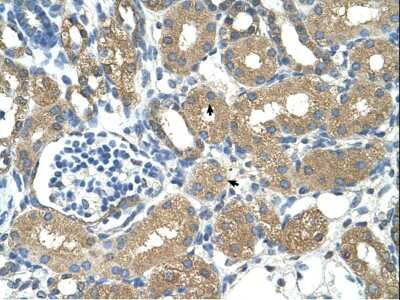 Immunohistochemistry: alcohol dehydrogenase 4 Antibody [NBP3-10572]