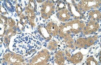 Immunohistochemistry-Paraffin: alcohol dehydrogenase 4 Antibody [NBP1-53173]