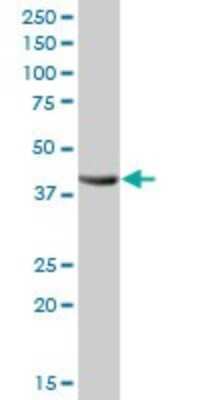 Western Blot: alcohol dehydrogenase 4 Antibody [H00000127-B01P]