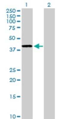 Western Blot: alcohol dehydrogenase 4 Antibody [H00000127-D01P]