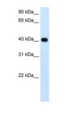 Western Blot: alcohol dehydrogenase 4 Antibody [NBP1-53173]