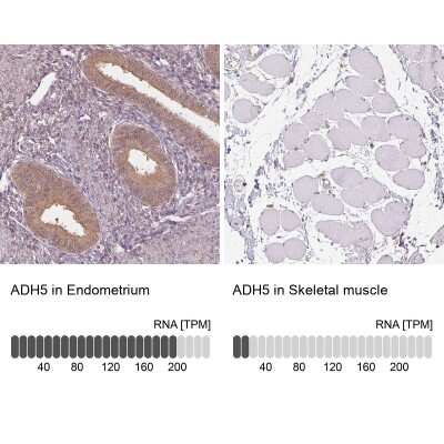 Immunohistochemistry-Paraffin: alcohol dehydrogenase 5 Antibody [NBP2-49350]