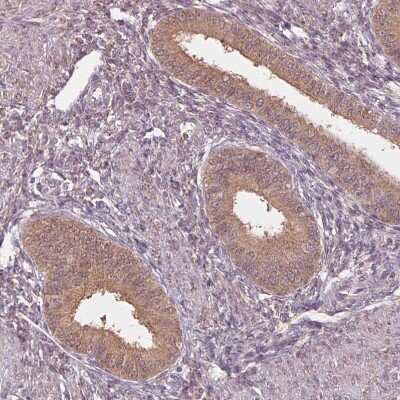 Immunohistochemistry-Paraffin: alcohol dehydrogenase 5 Antibody [NBP2-49350]