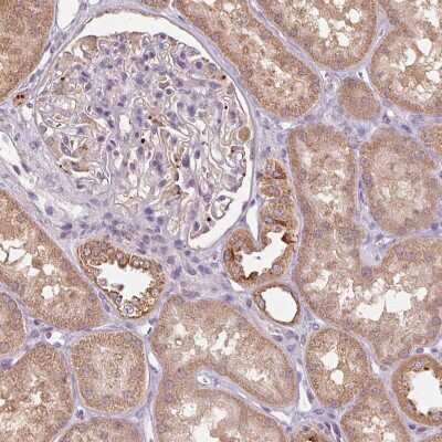 Immunohistochemistry-Paraffin: alcohol dehydrogenase 5 Antibody [NBP2-49350]